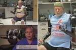 Des prothèses bioniques pour changer la vie des amputés